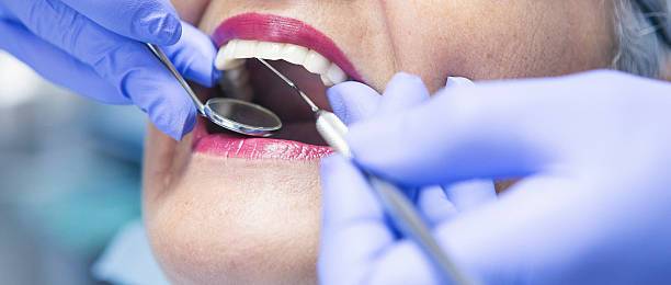 Best Chipped Tooth Repair Near Me  in Marlow, OK